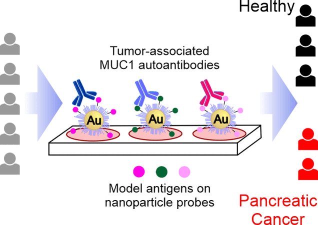 Faster Detection of Pancreatic Cancer - Glycopeptide probes detect tumor-associated antibodies in blood samples Faster Detection of Pancreatic Cancer - Glycopeptide probes detect tumor-associated antibodies in blood samples