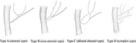 Figure1