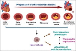 Redefining Macrophage Heterogeneity in Atherosclerosis: A Focus on Possible Therapeutic Implications