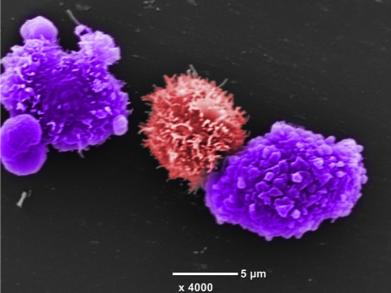 Clinical Translational Immunology